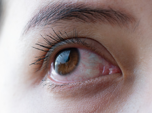 Gambar mata sebagai simbol tempat terjadinya penyakit glaukoma